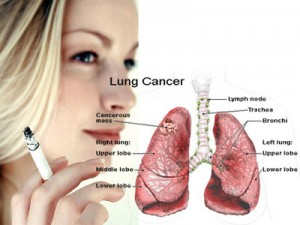Seorang Perokok Berisiko Tinggi Terhadap Kanker Paru-paru