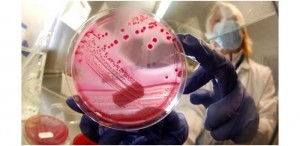 e-coli-1