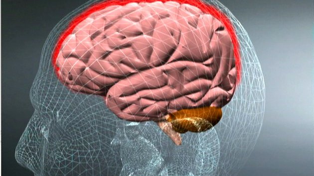 Apa yang perlu diketahui tentang Meningitis?
