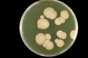 Candida_albicans_PHIL_3192_lores
