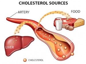 Tips Mengelola Kolesterol Anda Tetap Normal