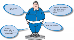 effects-of-childhood-obesity.gif