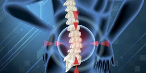 19-vitamin-d-deficiency-back-pain-fb-640x336