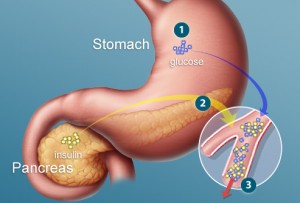 webmd_illustration_of_stomach_and_pancreas