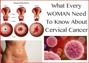 What-Every-WOMAN-Need-To-Know-About-Cervical-Cancer