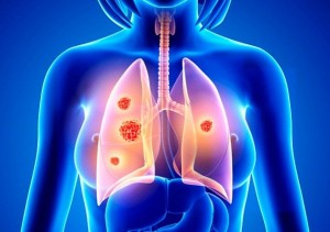 31F8E1A400000578-3481226-The_study_found_that_high_glycemic_foods_increase_the_risk_of_lu-a-2_1457392195802