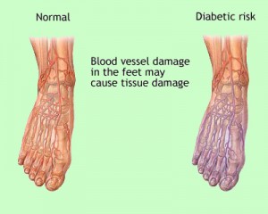 Diabetic-Foot-Care