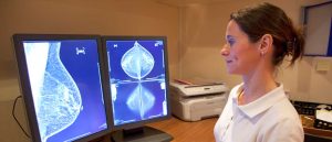 Tak Perlu Khawatir Berlebihan Dengan Hasil Mammografi