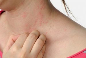 Kemampuan Kolostrum Dalam Melawan Alergi