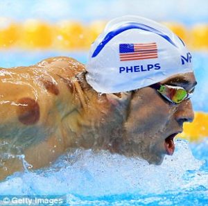 Tanda Ungu Gelap “Bekam” perenang USA Michael Phelps saat beraksi di Olimpiade Rio de Janeiro