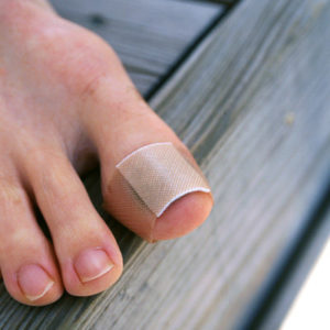 gout-injury-toe-400x400