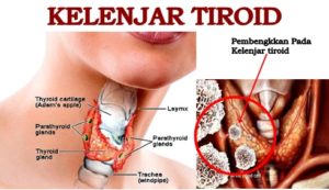kelenjar-tiroid-1
