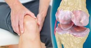 Makanan Yang Perlu Dihindari Penderita Osteoarthritis