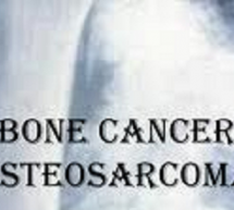 Sekilas Tentang Osteosarcoma (Kanker Tulang) Pada Remaja